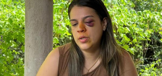 Corretora agredida pelo marido em Teresina passa por exames e tem quadro agravado
