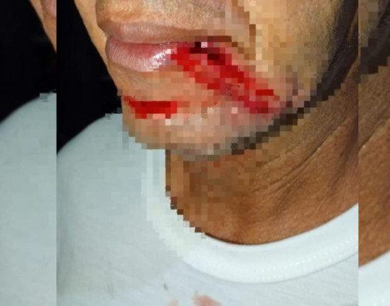 Padeiro fica ferido após fio de telefone enrolar em seu pescoço na zona Norte de Teresina