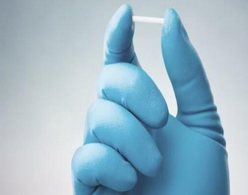 Implante contraceptivo passa a ser ofertado pelo SUS