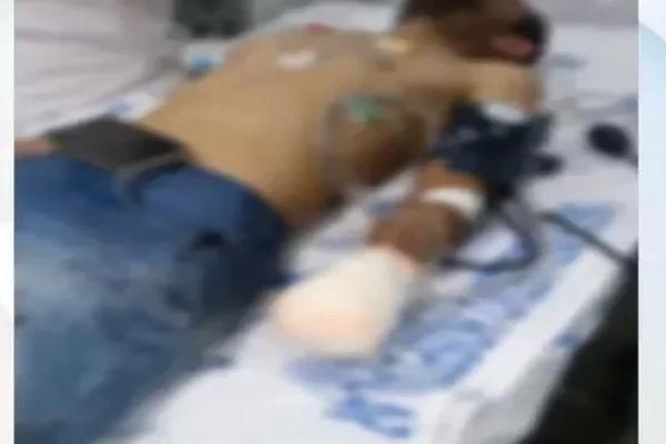Homem tem mão decepada após briga por cerca em Campo Maior