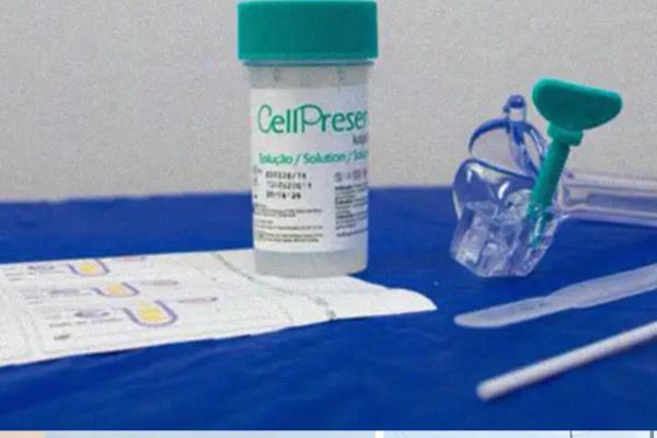 Novo teste molecular passa a ser adotado no SUS para prevenir câncer