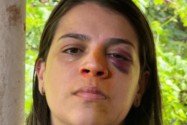 “Tenho medo de morrer”, diz mulher agredida pelo marido na zona sudeste de Teresina