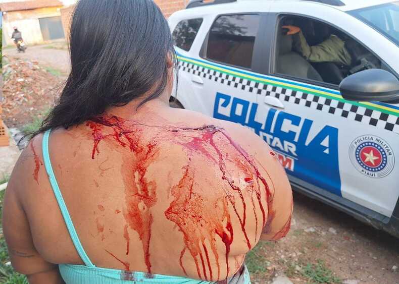 Mulher vítima de tentativa de feminicídio é esfaqueada diversas vezes na Zona Leste