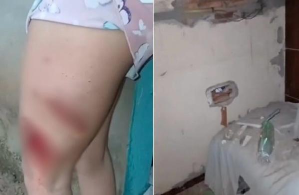 Mulher é atingida por raio dentro de casa durante chuva em Buriti dos Lopes