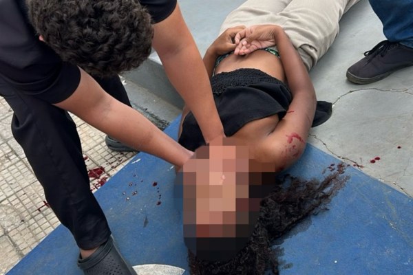 Mulher é arremessada após batida entre moto e carro na zona leste