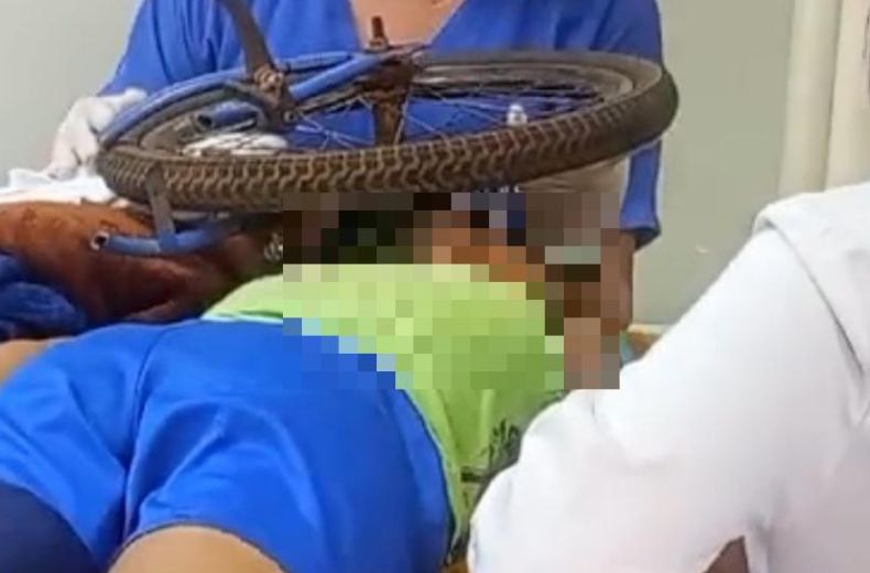 Criança de 9 anos fica com bicicleta presa ao crânio após acidente em Minas Gerais