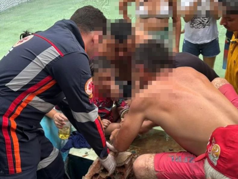 Criança é resgatada após ficar com o braço preso na boquilha de piscina em Cocal