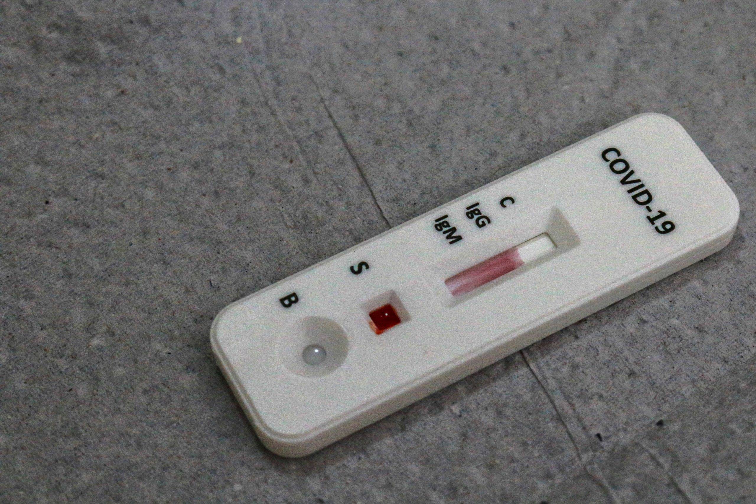 Hospitais municipais de Teresina ampliam testagem para COVID-19 durante o feriado de Ano Novo