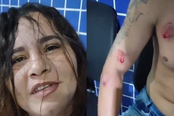 Mulher ataca companheiro e amante a dentadas após saber de traição em Parnaíba
