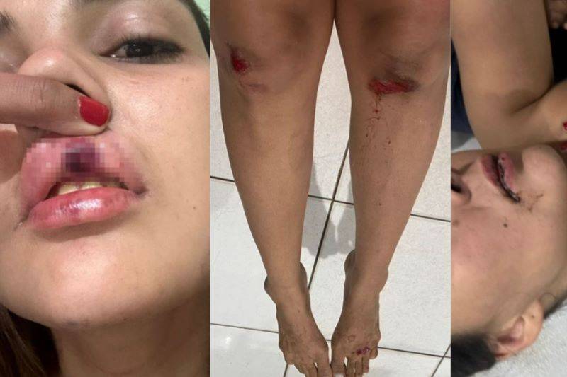 Mulher é espacanda por namorado no Norte do Piauí