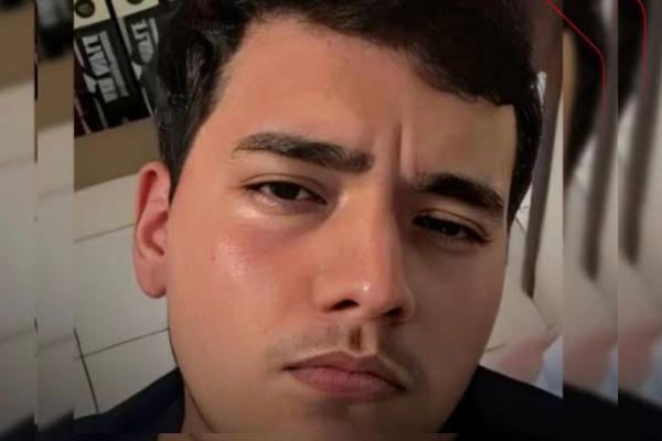 Estudante de Direito morre após colisão entre moto e carro na BR-316 em Picos